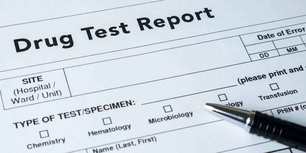 Drug Test Report
